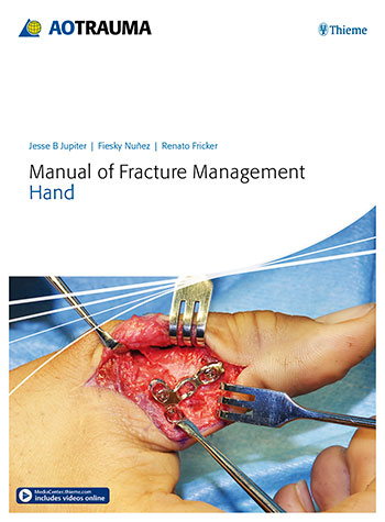 Manual of Fracture Management—Hand